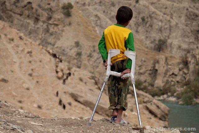 مصایب سبحان؛ کودکی که زانو ندارد